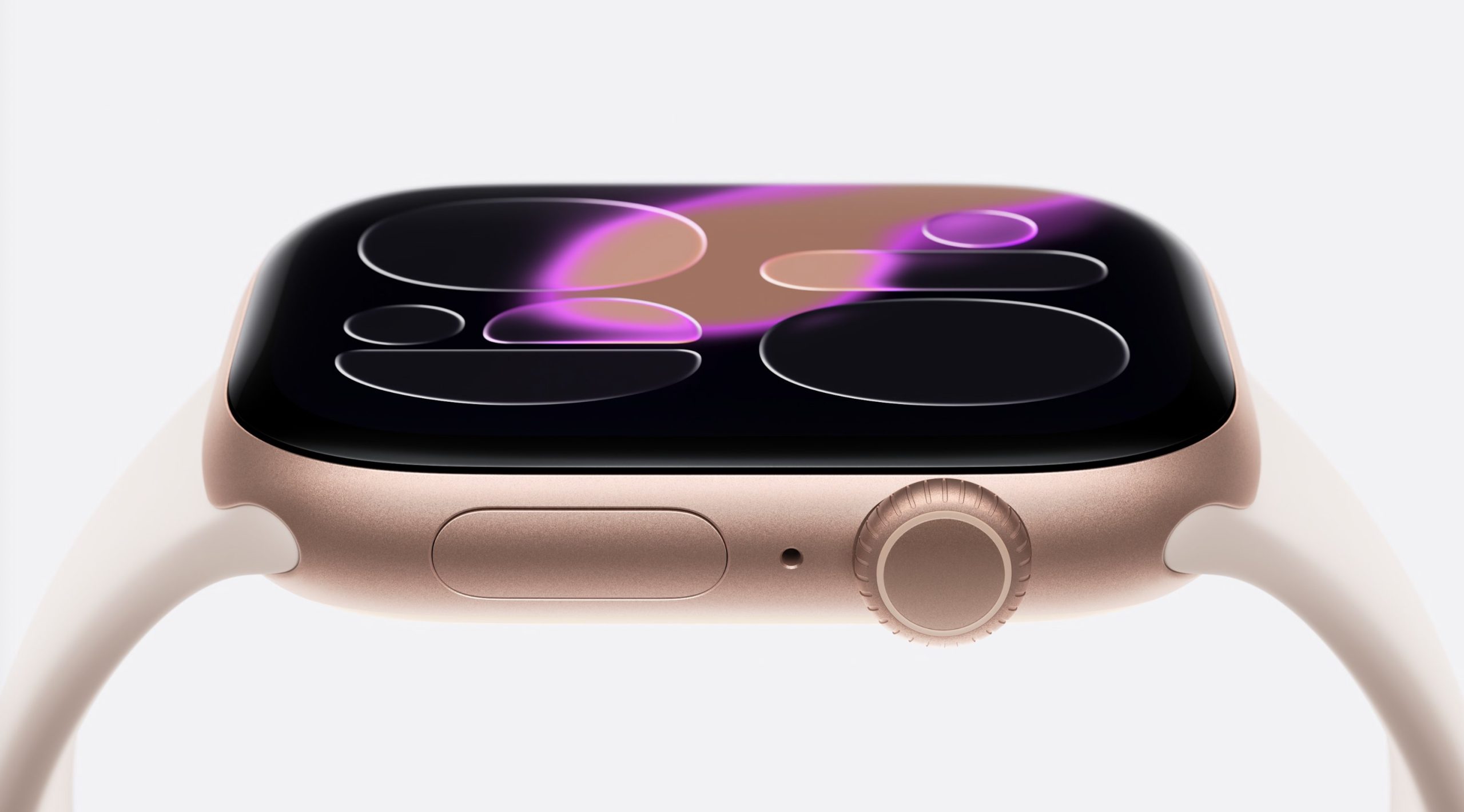 Apple Watch Series 11 en or