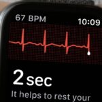 Apple publie un autre cas de détection d'arythmie cardiaque qui sauve la vie d'un athlète