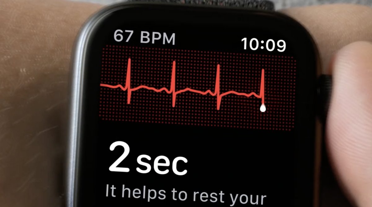 Apple publie un autre cas de détection d'arythmie cardiaque qui sauve la vie d'un athlète