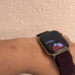 Certains utilisateurs signalent des problèmes d'irritation avec les nouvelles Apple Watch Series 12 et Ultra 4