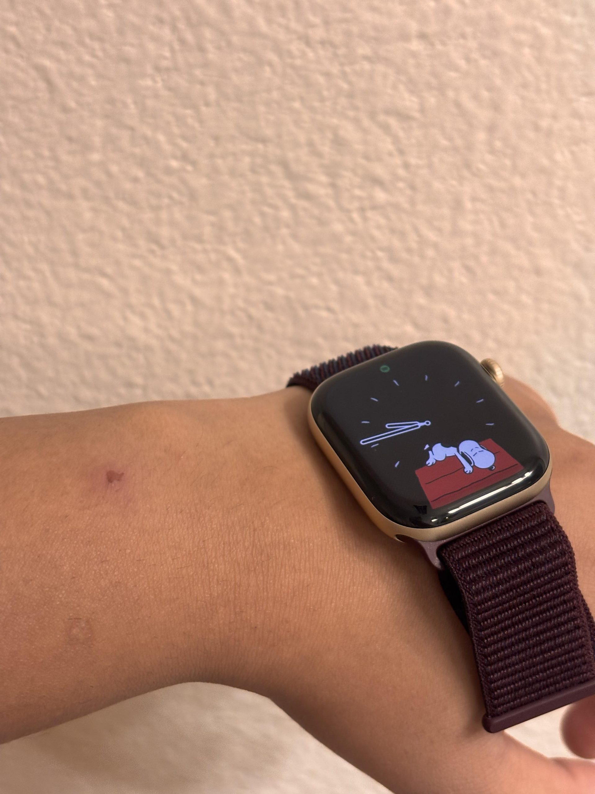 Irritación en la piel causada por un Apple Watch Series 12